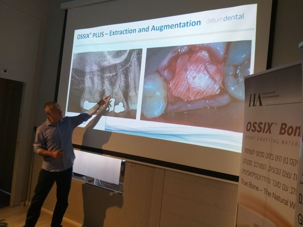 קורס אוגמנטציה לחברי איגוד שיקום הפה עם דר יובל צוברי 10.07.19