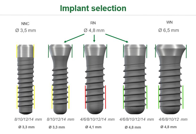 decor-line TISSUE LEVEL SLActive decor-line