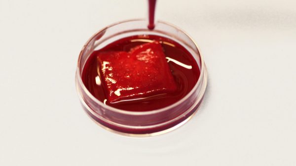 פליז המוסטטי