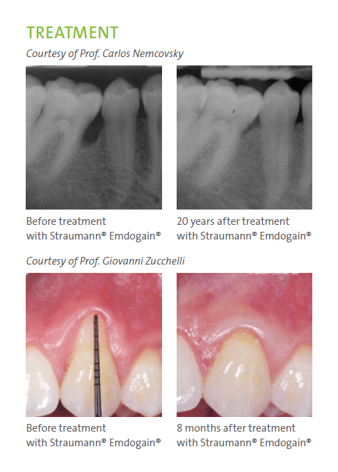 שימוש באמדוגיין לפני ואחרי